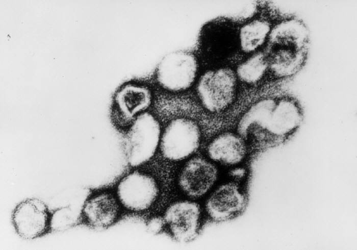 The rubella virus. Image courtesy CDC.