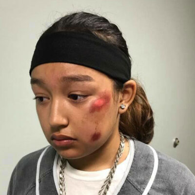 Rising racial tension in North Carolina stirs beneath a police officer's alleged assault on 13 year old